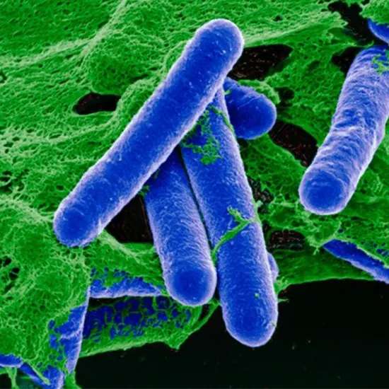 Clostridium Botulinum : A Tiny Bacterium With A Big Impact On Food Safety